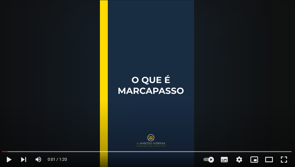 Teste de Inclinação (Tilt-Test) - Centro de Arritmias Cardíacas do Cariri